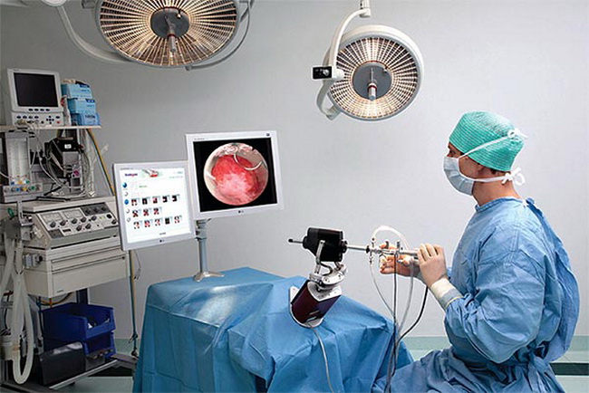 sockel hysteroskopie simulator 06